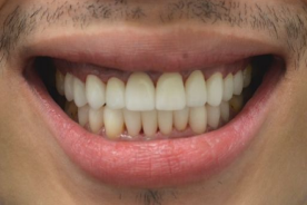 Изображение После