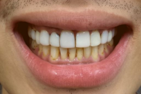 Изображение До