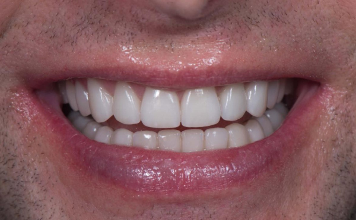 Изображение После